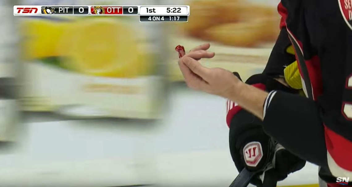 Car Accident Lawyer Brooklyn Dans Video Sidney Crosby Slashes Marc Methot’s Fingertip Off Doesn’t