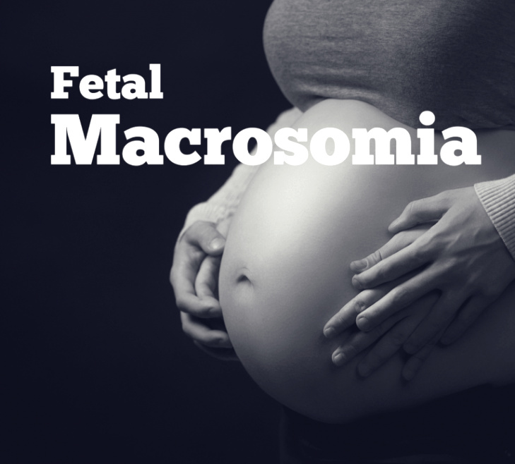 Pa Car Accident Lawyer Dans Fetal Macrosomia and Medical Malpractice