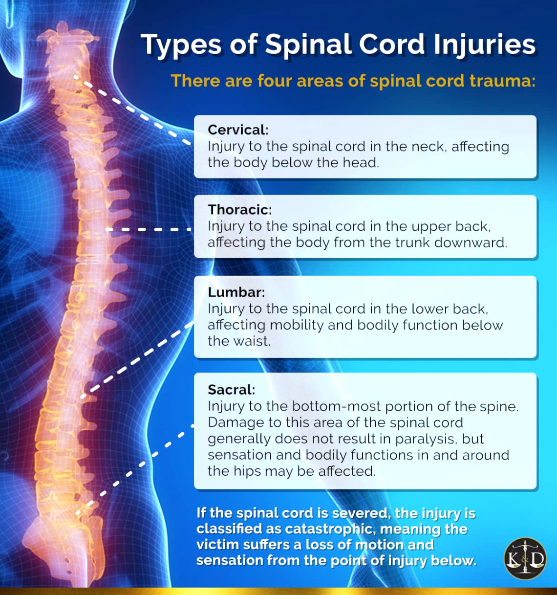 Spinal Cord Injuries Lawyer Dans Spinal Cord Injury attorney Kogan & Disalvo