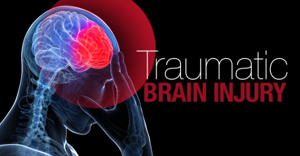 Houston Motorcycle Accident Lawyer Dans Football and Traumatic Brain Injuries